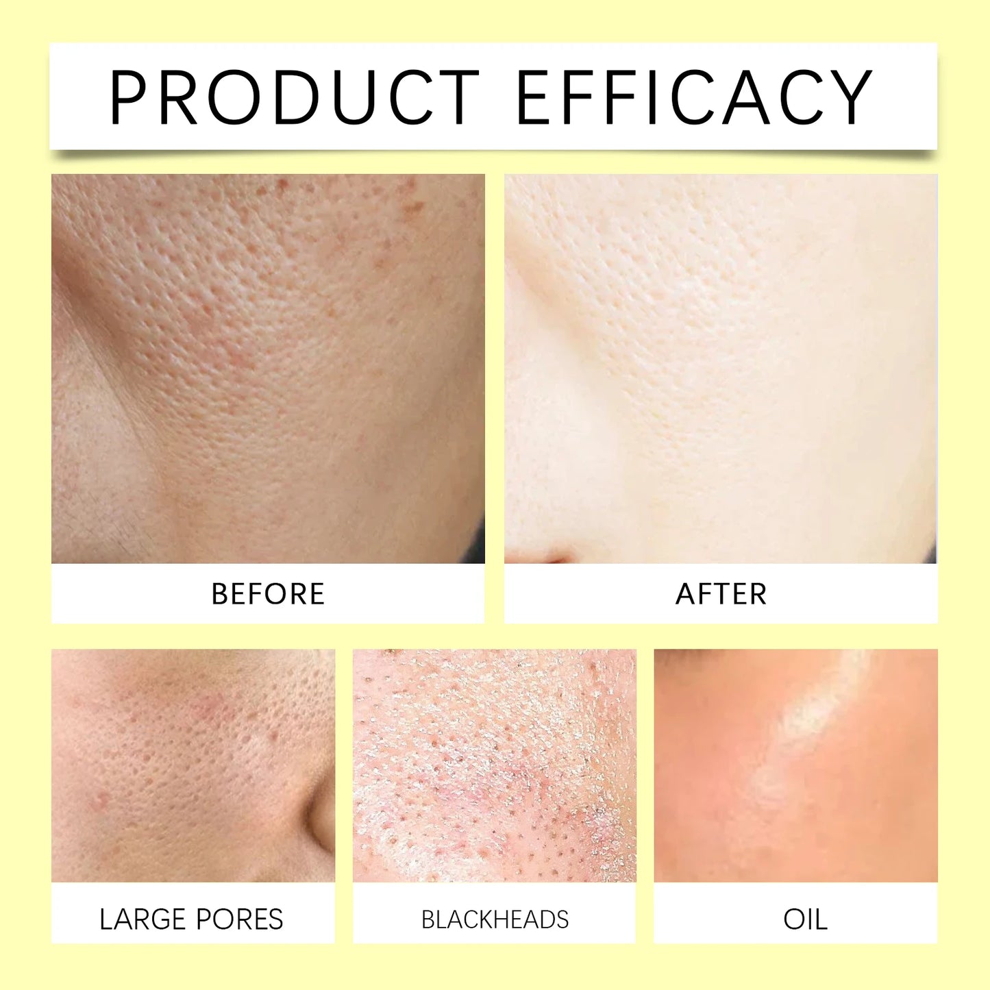 Turmeric Kojic Acid Cleansing Pad Gently Exfoliates Deeply Cleanses Skin Whitens And Lightens Spots Maintains Water Oil Balance